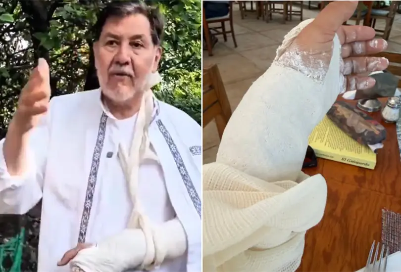Así fue la caída que dejó a Noroña con la muñeca fracturada Así fue la caída que dejó a Noroña con la muñeca fracturada