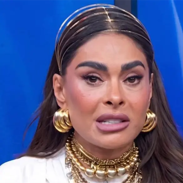 Galilea Montijo habla de la parálisis que sufre por un mal procedimiento estético Galilea Montijo habla de la parálisis que sufre por un mal procedimiento estético