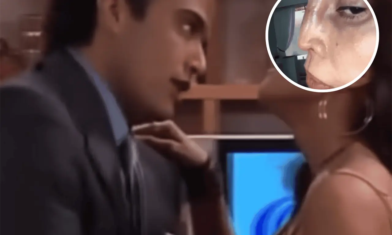  La actriz que interpretó a una modelo fue sometida a una cirugía de nariz que transformó su rostro y perjudicó su salud. 