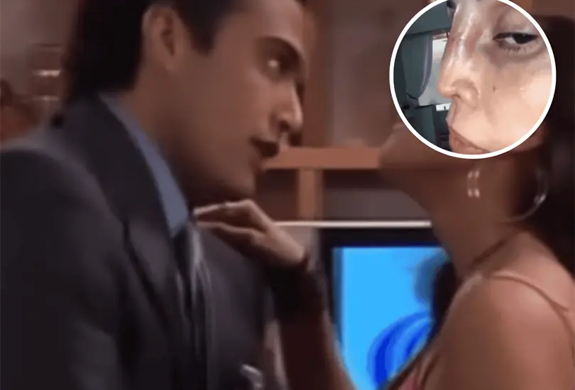 La actriz que interpretó a una modelo fue sometida a una cirugía de nariz que transformó su rostro y perjudicó su salud. La actriz que interpretó a una modelo fue sometida a una cirugía de nariz que transformó su rostro y perjudicó su salud.