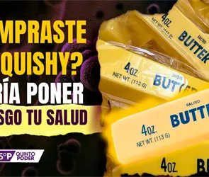 Alertan por componentes cancer&iacute;genos en imitaciones de mantequilla squishy