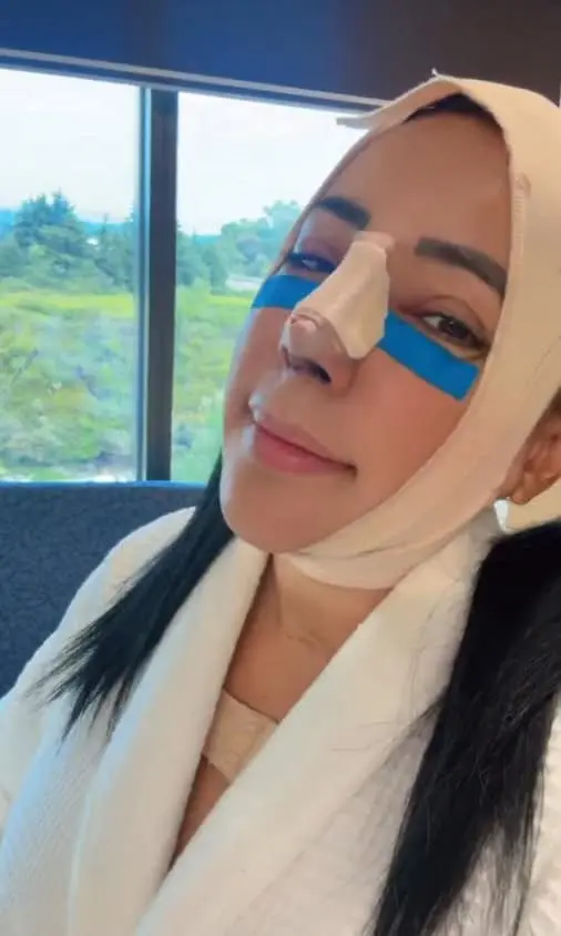La aparición de Sandra Cuevas generó comentarios entre usuarios de redes sociales debido a los cambios visibles en su rostro y a la presencia de una férula nasal. RRSS.