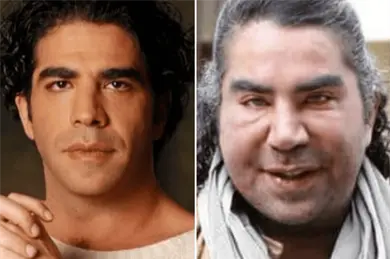 Muerte de Jorge Kahwagi: &iquest;Qu&eacute; cirug&iacute;as se hizo el exboxeador y diputado en la cara?
