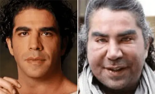 Muerte de Jorge Kahwagi: ¿Qué cirugías se hizo el exboxeador y diputado en la cara? Muerte de Jorge Kahwagi: ¿Qué cirugías se hizo el exboxeador y diputado en la cara?