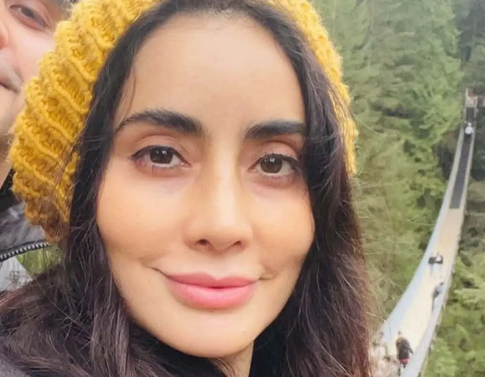 Reconoce que cada seis meses se pone ácido hialurónico en los labios.<br> Reconoce que cada seis meses se pone ácido hialurónico en los labios.<br>