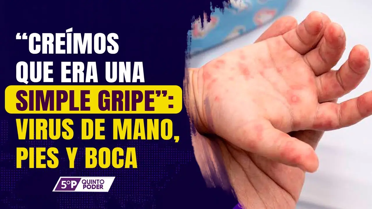  Virus de manos, pies y boca: síntomas, tratamiento y casos. 