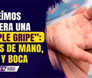 Enfermedad de manos, pies y boca: s&iacute;ntomas y casos en M&eacute;xico