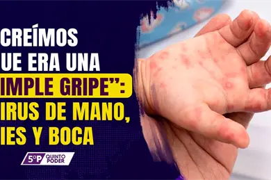 Enfermedad de manos, pies y boca: síntomas y casos en México Enfermedad de manos, pies y boca: síntomas y casos en México