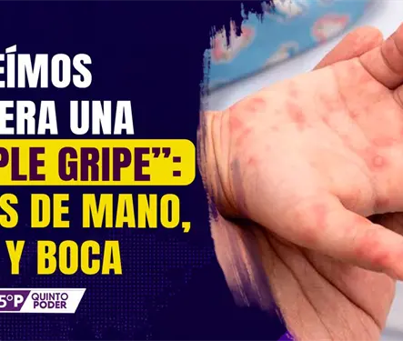 Enfermedad de manos, pies y boca: s&iacute;ntomas y casos en M&eacute;xico