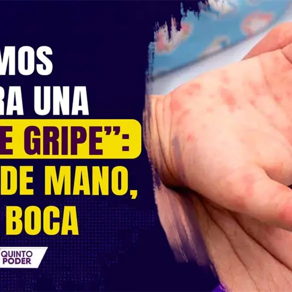 Enfermedad de manos, pies y boca: síntomas y casos en México Enfermedad de manos, pies y boca: síntomas y casos en México