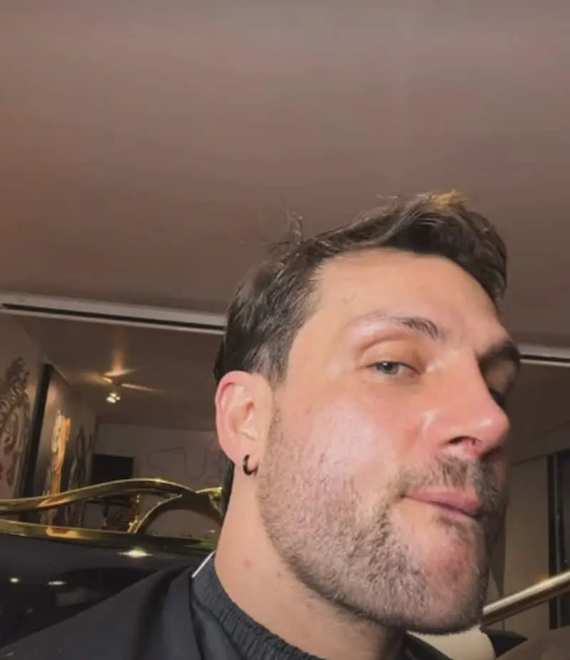 Nicola Porcella con su cirugía de nariz Redes sociales