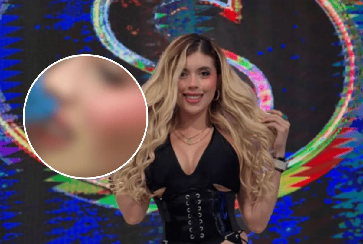  Así quedó el rostro de Isabella Rojas tras recibir un golpe de dron durante una emisión de Es Show; Ernesto Chavana habló sobre lo ocurrido. 