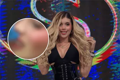 Isabella Rojas muestra cómo quedó su rostro tras ser golpeada con un dron que pateó Ernesto Chavana Isabella Rojas muestra cómo quedó su rostro tras ser golpeada con un dron que pateó Ernesto Chavana