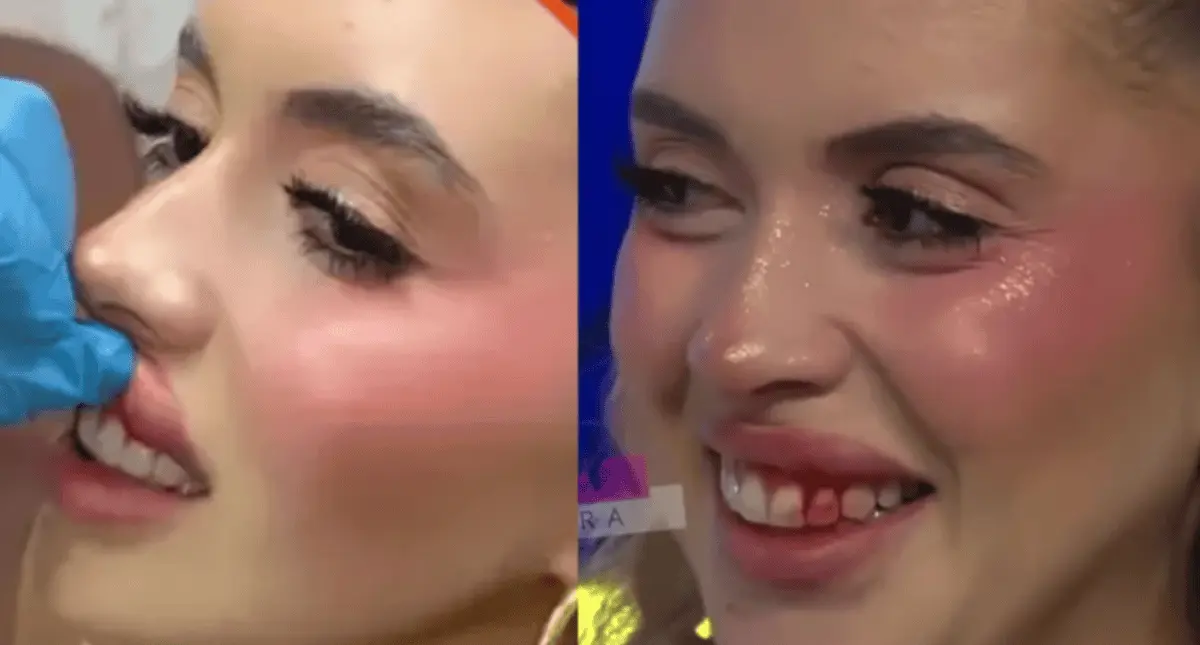 Isabella Rojas tras el accidente Especial