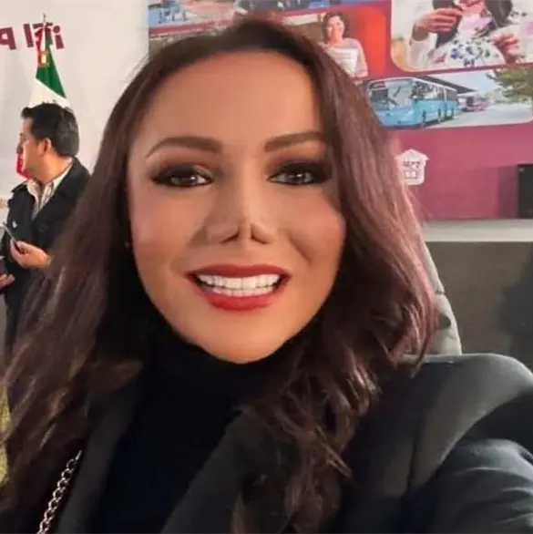 Carolina Guevara, regidora de Coacalco, pide respeto por su nariz tras fotos virales de su cirug&iacute;a