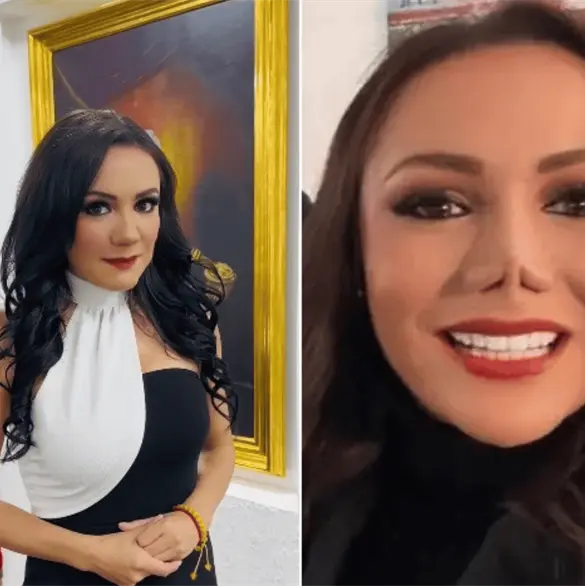 ¿Qué le pasó en la nariz a Carolina Guevara, regidora de Coacalco? ¿Qué le pasó en la nariz a Carolina Guevara, regidora de Coacalco?