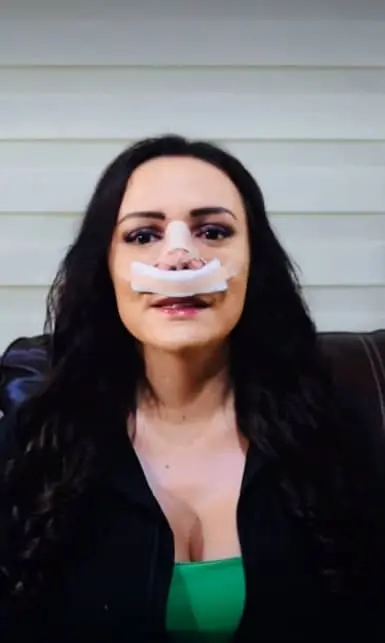 La política mexicana compartió un video en sus redes sociales en el que apareció con vendas en la nariz y habló sobre el proceso médico que ha enfrentado. RRSS.